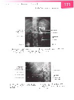 Sobotta  Atlas of Human Anatomy  Trunk, Viscera,Lower Limb Volume2 2006, page 178